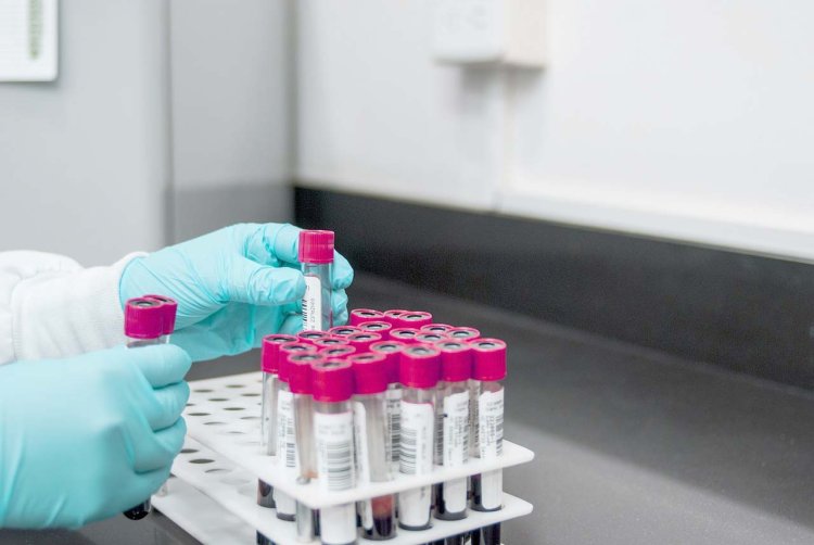 Exames de sangue antecipados